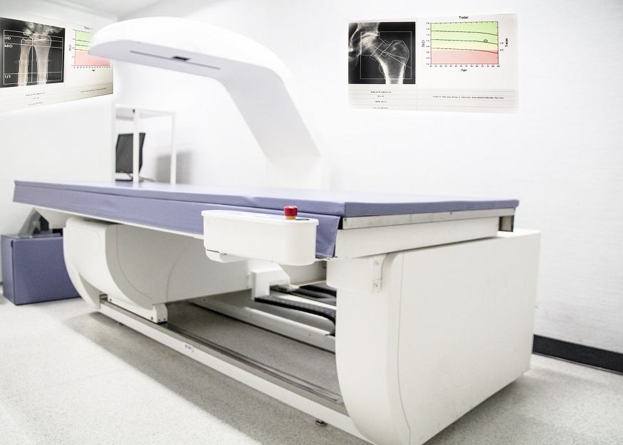 Imagen: La IA puede proporcionar un análisis rápido de los resultados de detección de osteoporosis de rutina e informar el puntaje de calcificación (Fotografía cortesía de Shutterstock) Imagen: La IA puede proporcionar un análisis rápido de los resultados de detección de osteoporosis de rutina e informar el puntaje de calcificación (Fotografía cortesía de Shutterstock)